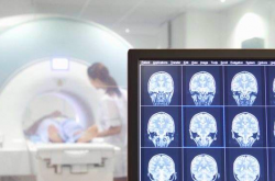 AI诊断乳腺癌准确率近100%