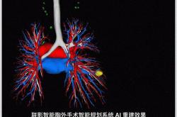 21对话｜联影智能首席科学家高耀宗：人机协同是AI医疗最优解