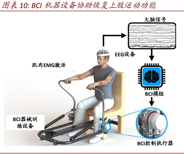 脑机接口技术应用迈出坚实一步