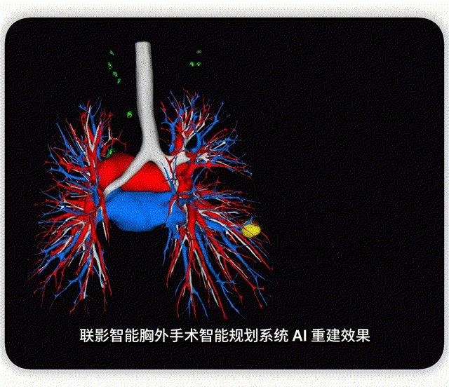 21对话｜联影智能首席科学家高耀宗：人机协同是AI医疗最优解