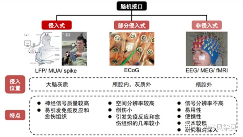 新华视点｜植入人脑之后，脑机接口技术将如何改变我们的生活？